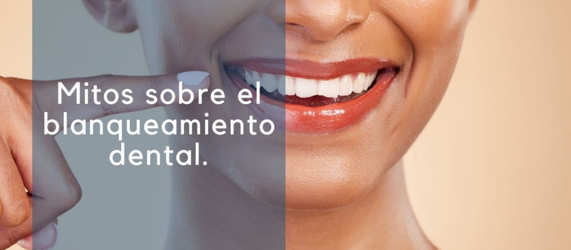 Mitos sobre el blanqueamiento dental